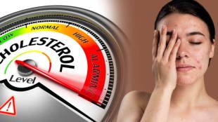 high cholesterol face symptoms