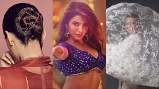 bollywood actress skin problem