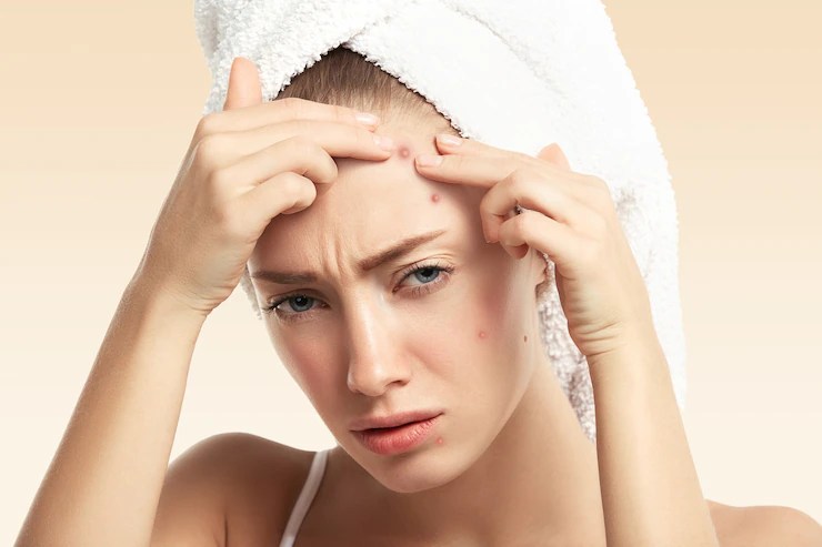 These five morning habits can cause pimples