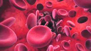 sickle cell patients