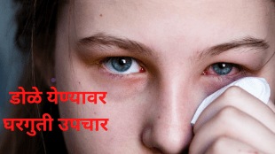 What is Dole Yene in English Know About Conjunctivitis symptoms home treatment ayurvedic upchar