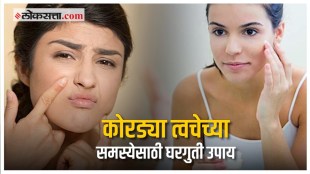 Dry Skin Home Remedies