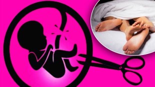 physical relationship after caesarean delivery