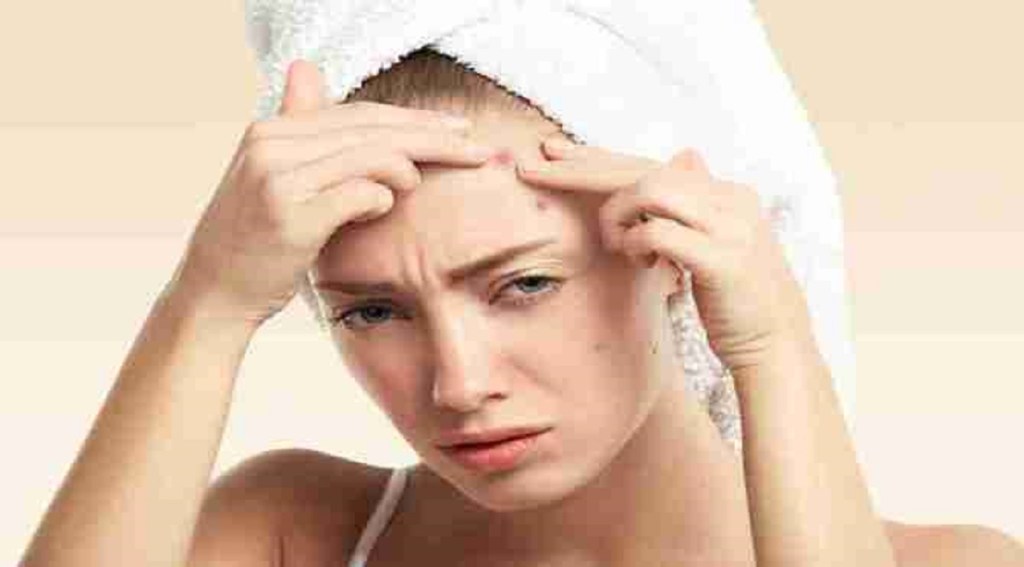 pimples