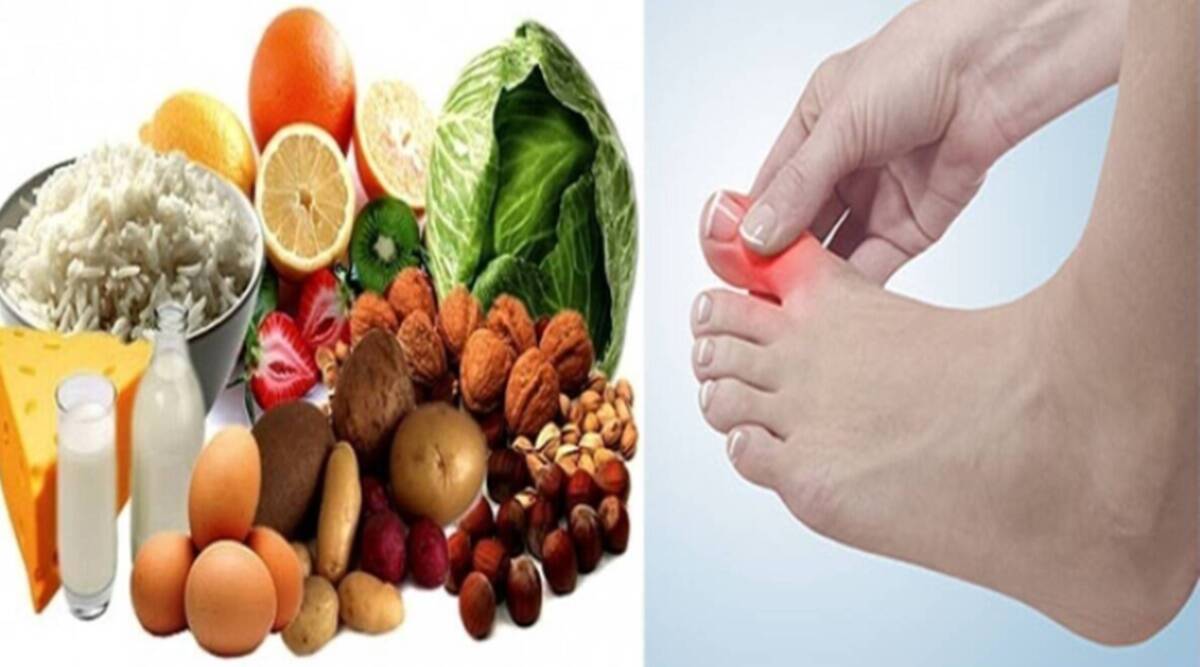 Fruits That Cause High Uric Acid Swollen Fingers Nausea Joint Pain ...