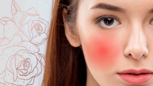 how to heal facial redness