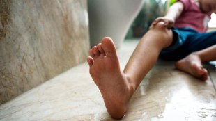 diabetic food ulcer