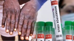 Monkeypox संदर्भात WHO ची मोठी घोषणा! आतापासून ‘हे’ असेल मंकीपॉक्सचं नवीन नाव, त्वरित वापरण्याचे केले आवाहन