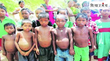 Malnutrition rates in india Malnutrition rates in india