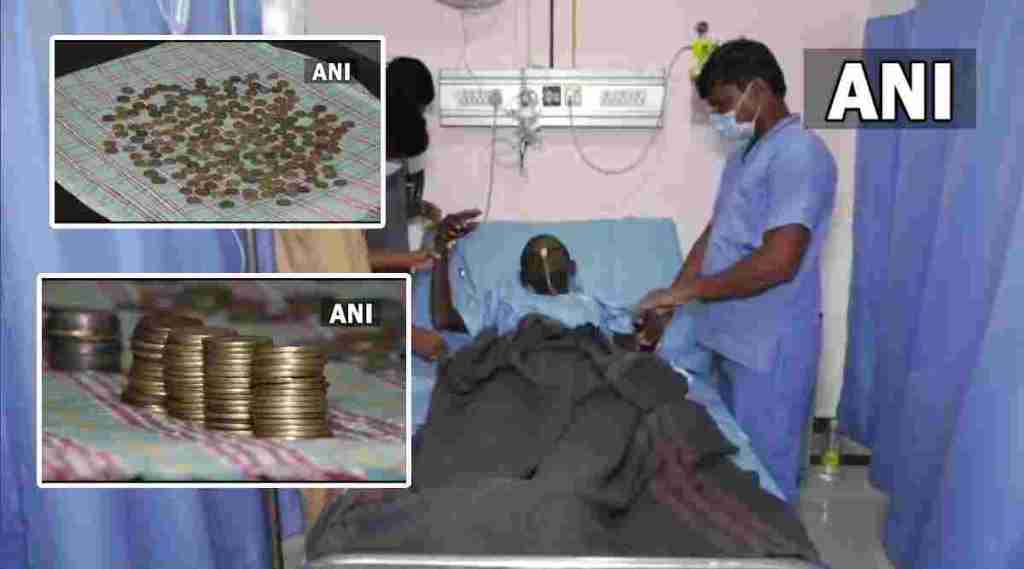 karnataka patient swallows coin