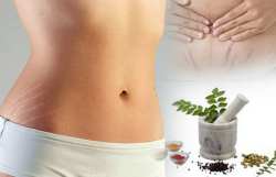 त्वचेवर स्ट्रेच मार्क्स आहेत? करा हे ४ उपाय, फरक दिसेल