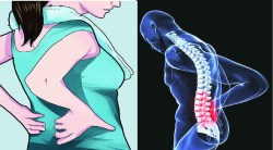 ‘या’ जीवनसत्वाच्या अभावानेही होऊ शकते कंबरदुखी, आराम मिळण्यासाठी करा ‘हे’ उपाय