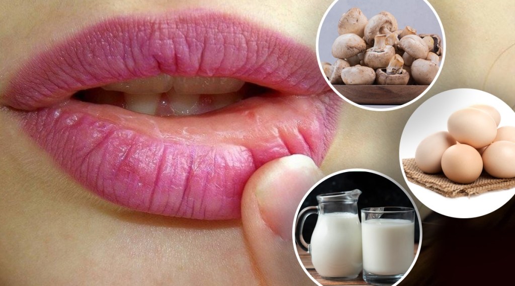 winter lips care