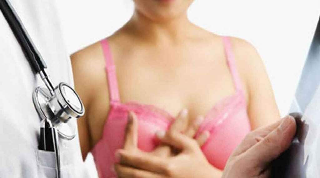 Diet during breast cancer treatment Diet during breast cancer treatment