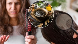 Dandruff and hair loss problem
