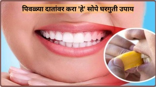 How To Get Whiter Teeth at Home Easy Tips To Get Rid Of Yellow Teeth