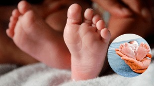 Girl Born With Four Legs Viral Photo Shocks Internet Extremely Rare case of Birth