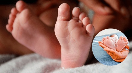 Girl Born With Four Legs Viral Photo Shocks Internet Extremely Rare case of Birth Girl Born With Four Legs Viral Photo Shocks Internet Extremely Rare case of Birth