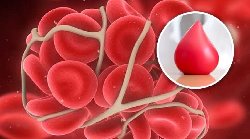 blood cloting sign blood cloting sign