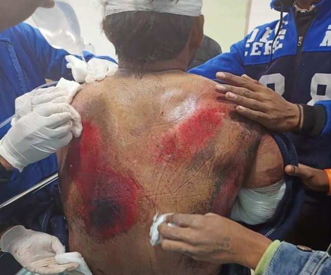 Cricketer Rishabh Pant Car Accident in Uttarakhand Photos