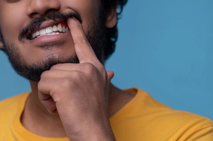 common mistakes increase the risk of AIDS