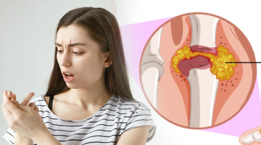 Gout Bones Get Stiff Due To Arthritis Know How To Reduce Uric Acid