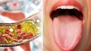 cholesterol sign in tounge