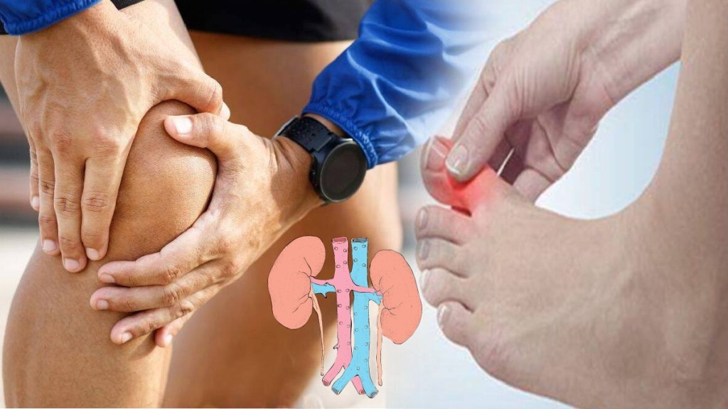 Uric Acid Causes and Prevention Tips Uric Acid Causes and Prevention Tips