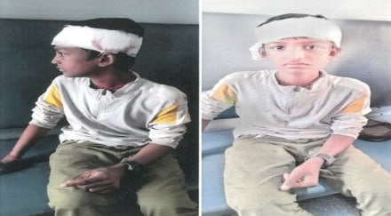 boy injured train pune