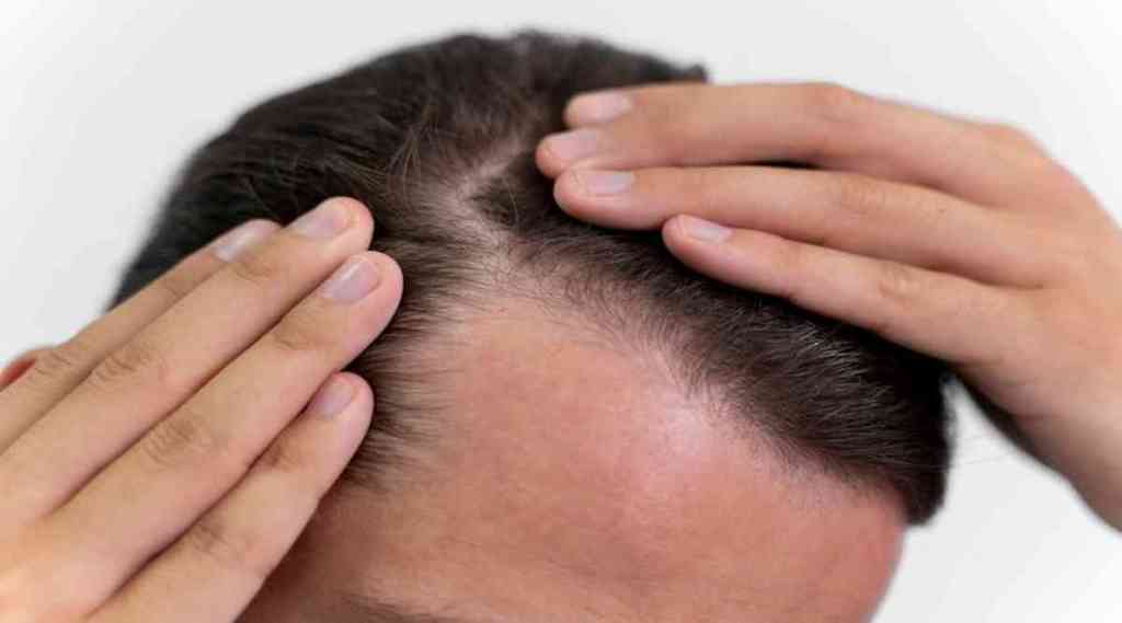 health news energy drinks causes hair loss