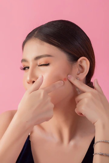 sleeping mistakes cause pimples