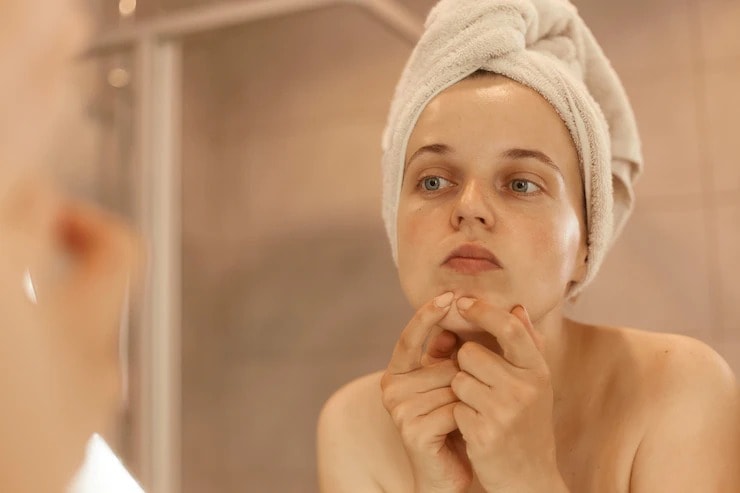 sleeping mistakes cause pimples