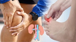 gout pain problem