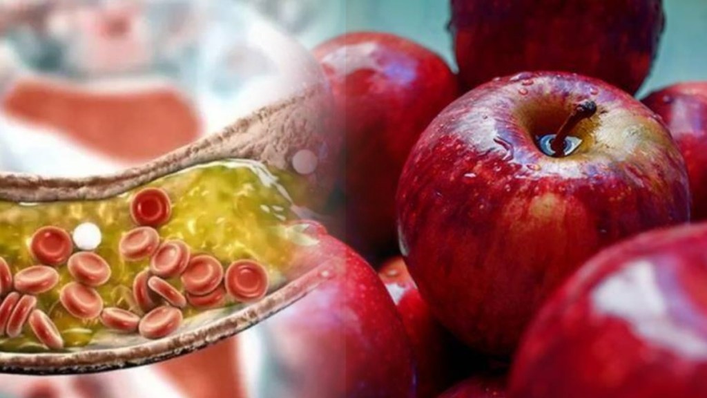 bad cholesterol causes