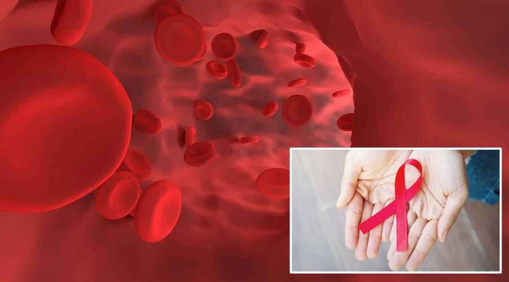 seven year old boy with hiv positive