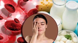 skincare pimple problem