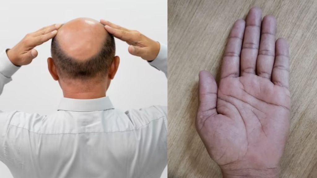 Hair care Tips