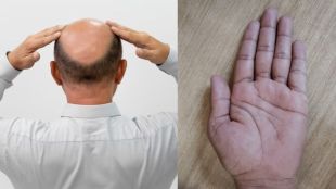 Hair care Tips