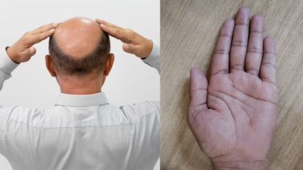 Hair care Tips