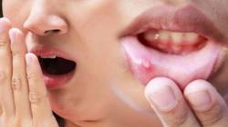 World Oral Health Day: तोंडाची स्थिती पाहून आजाराचे निदान करता येते का? मौखिक आरोग्य आणि शरीर यांमध्ये काय संबंध असतो?