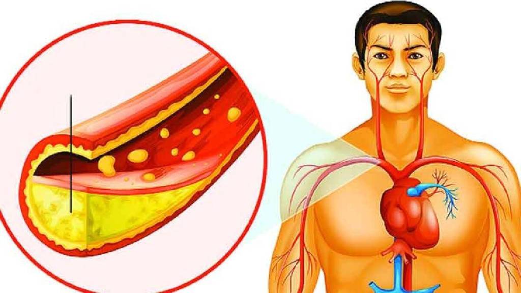 lemon garlic for bad cholesterol