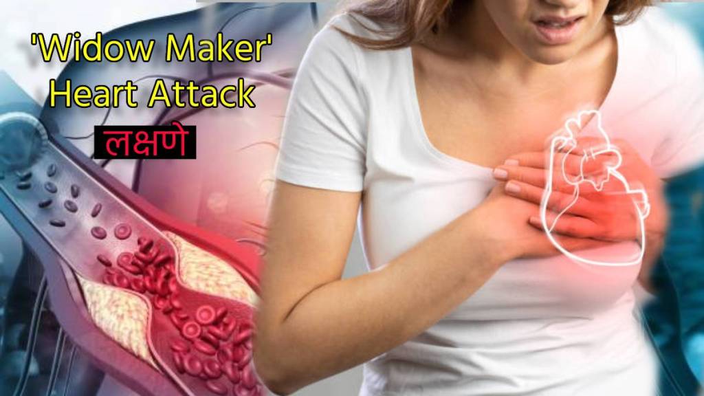 What is a Widow Maker heart attack Happen Due To Bad Cholesterol Early Signs That Can Cause Death Know From Expert What is a Widow Maker heart attack Happen Due To Bad Cholesterol Early Signs That Can Cause Death Know From Expert