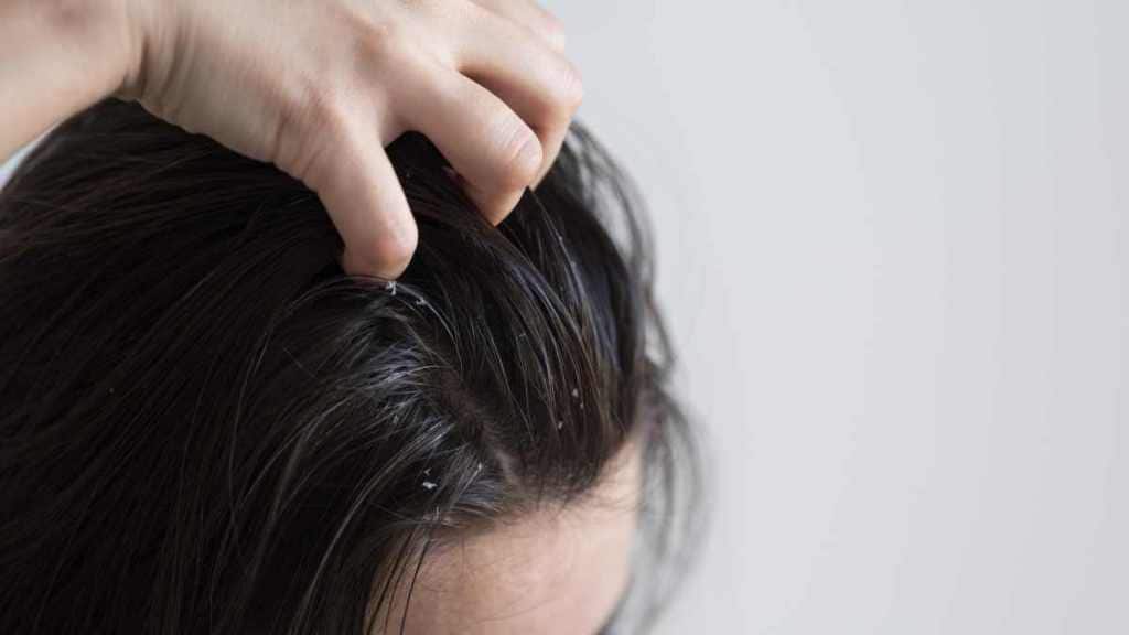 Reasons your hair gets oily even after washing it Reasons your hair gets oily even after washing it