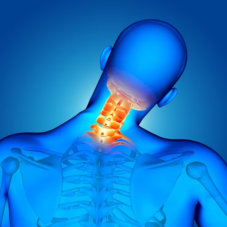 neck pain remedies