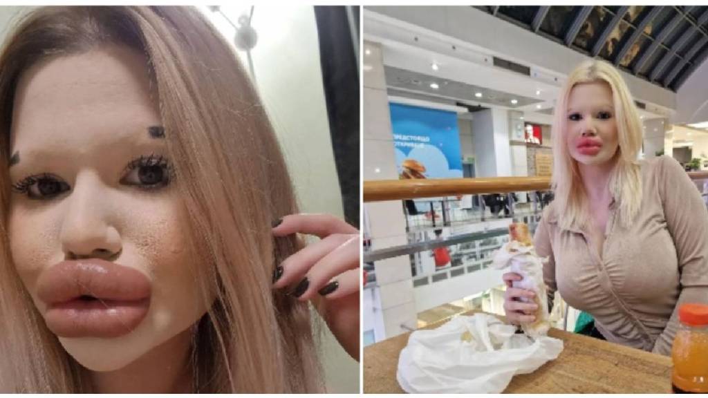 Worlds Biggest Lips woman struggling to find love see photo