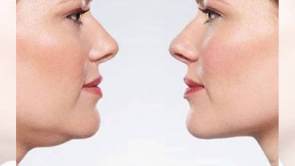 how to reduce neck fat