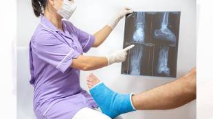 types of bone fractures and treatment