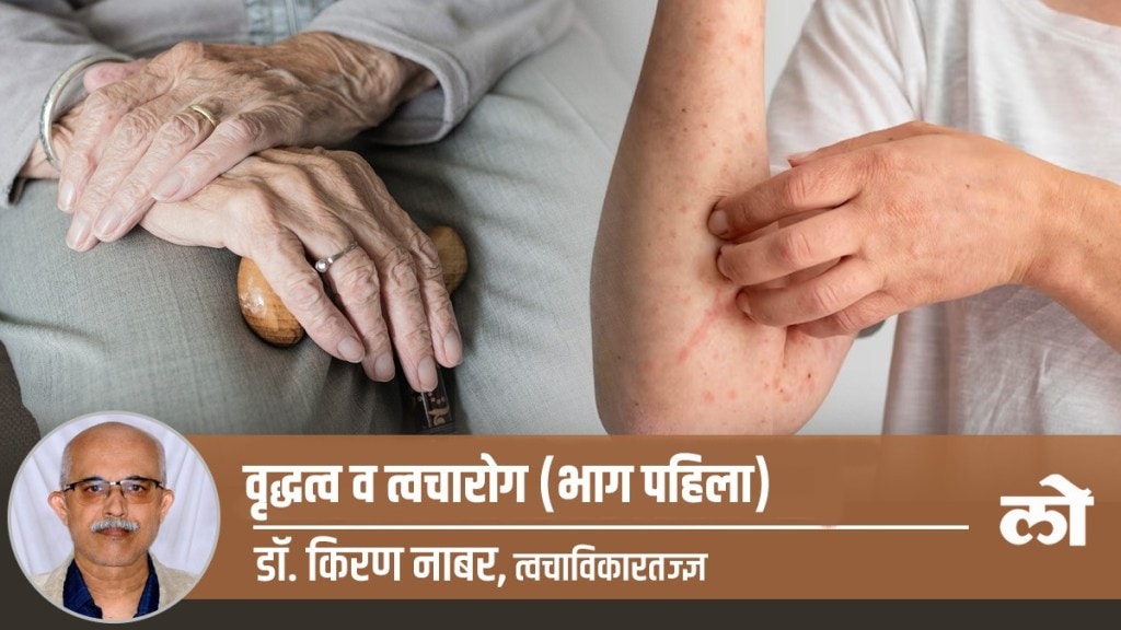 old age, skin diseases, precautions old age, skin diseases, precautions