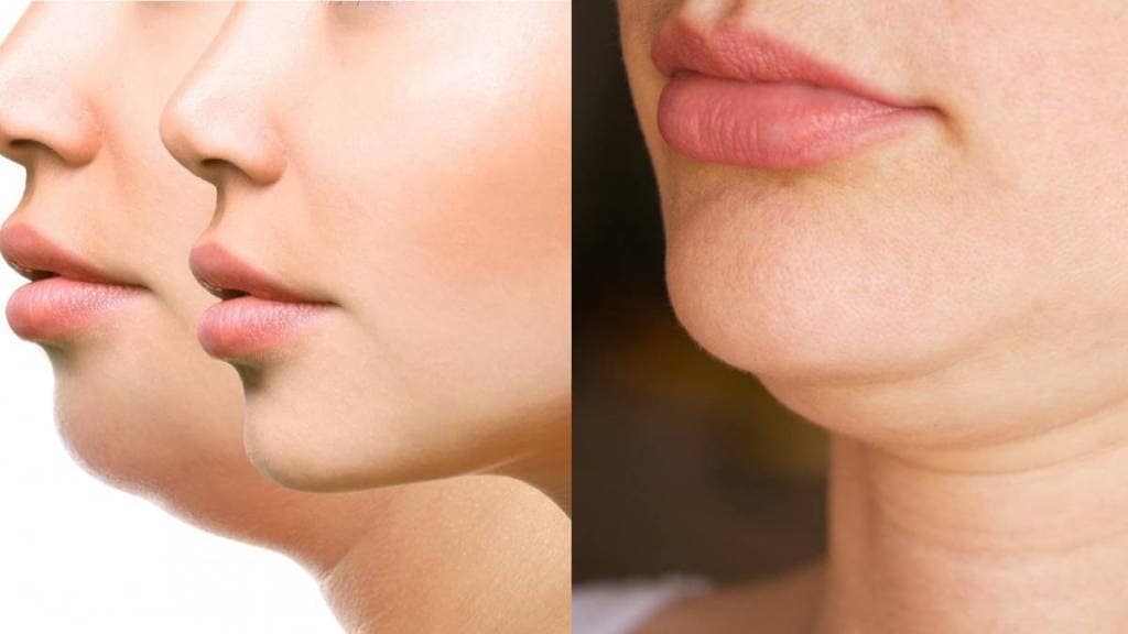 how to get perfect jaw line