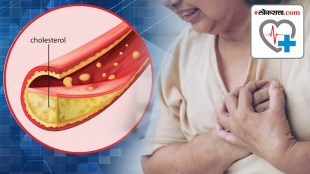 High cholesterol symptoms